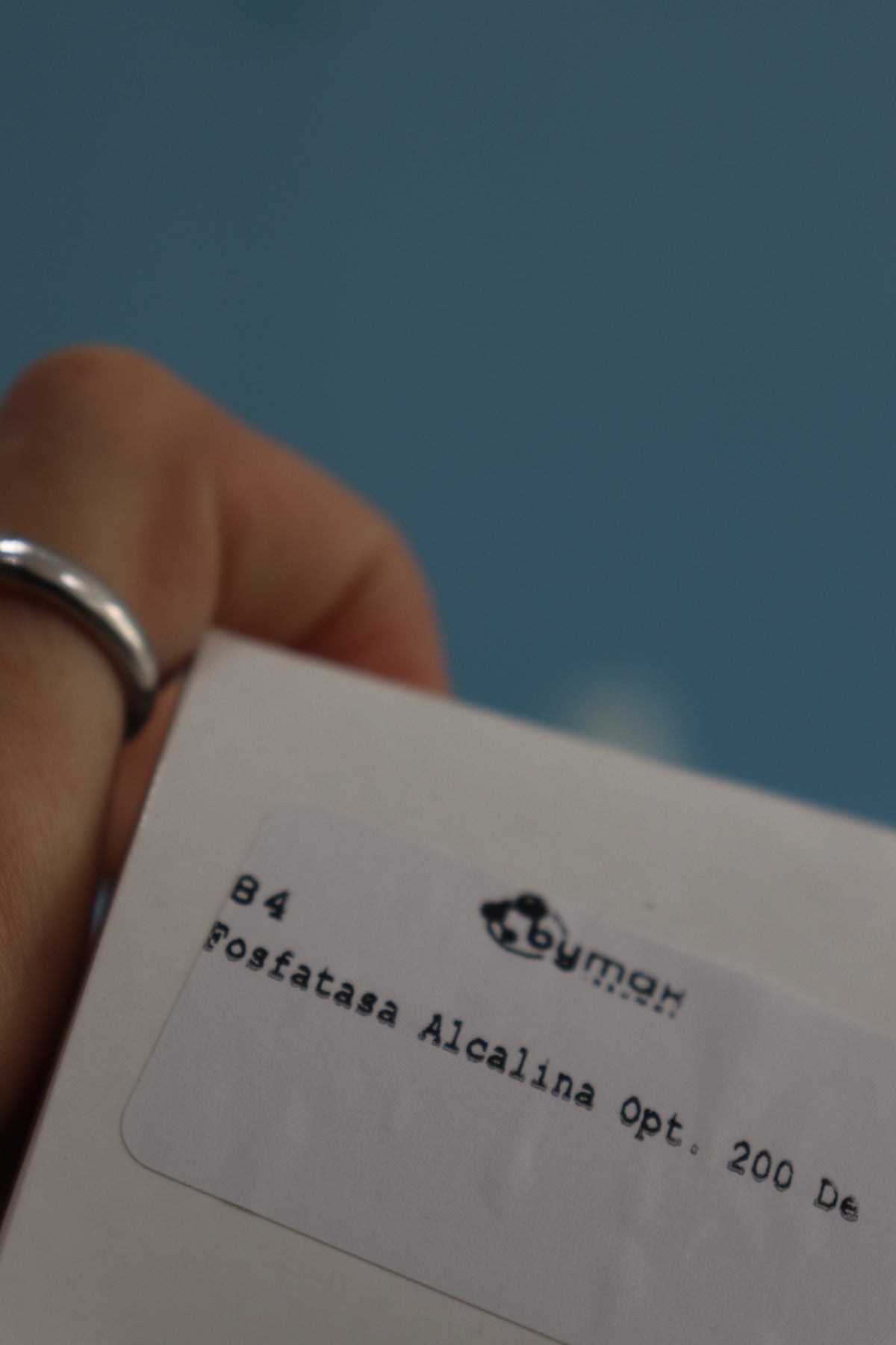 Fosfatasas Alcalina Optimizada  - 200 Det. - 1361003 - Wiener